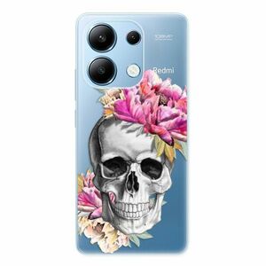 Odolné silikonové pouzdro iSaprio - Pretty Skull - Xiaomi Redmi Note 13 obraz