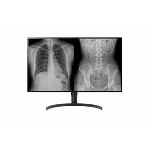 LG 32HL512D-B počítačový monitor 80 cm (31.5") 3840 x 32HL512D-B obraz