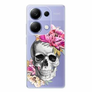 Odolné silikonové pouzdro iSaprio - Pretty Skull - Xiaomi Redmi Note 13 Pro obraz