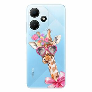 Odolné silikonové pouzdro iSaprio - Lady Giraffe - Infinix Hot 30i obraz