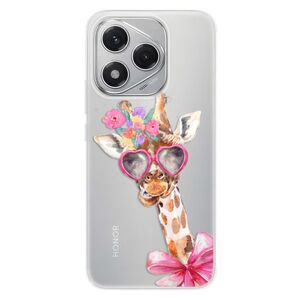 Silikonové pouzdro iSaprio - Lady Giraffe - Honor 400 Lite obraz