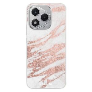 Silikonové pouzdro iSaprio - RoseGold 10 - Honor 400 Lite obraz