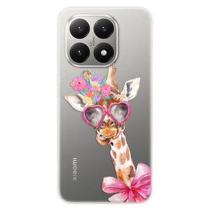 Silikonové pouzdro iSaprio - Lady Giraffe - Xiaomi 15T obraz