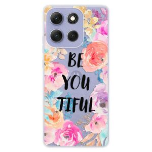 Silikonové pouzdro iSaprio - BeYouTiful - Motorola Moto G86 5G obraz
