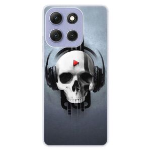 Silikonové pouzdro iSaprio - Skeleton M - Motorola Moto G86 5G obraz