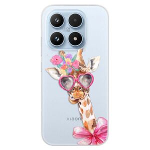 Silikonové pouzdro iSaprio - Lady Giraffe - Xiaomi 17 obraz