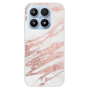 Silikonové pouzdro iSaprio - RoseGold 10 - Xiaomi 17 obraz