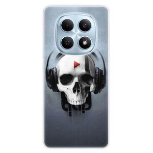 Silikonové pouzdro iSaprio - Skeleton M - Xiaomi Redmi Note 15 4G / 15 5G obraz
